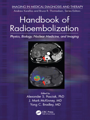 cover image of Handbook of Radioembolization